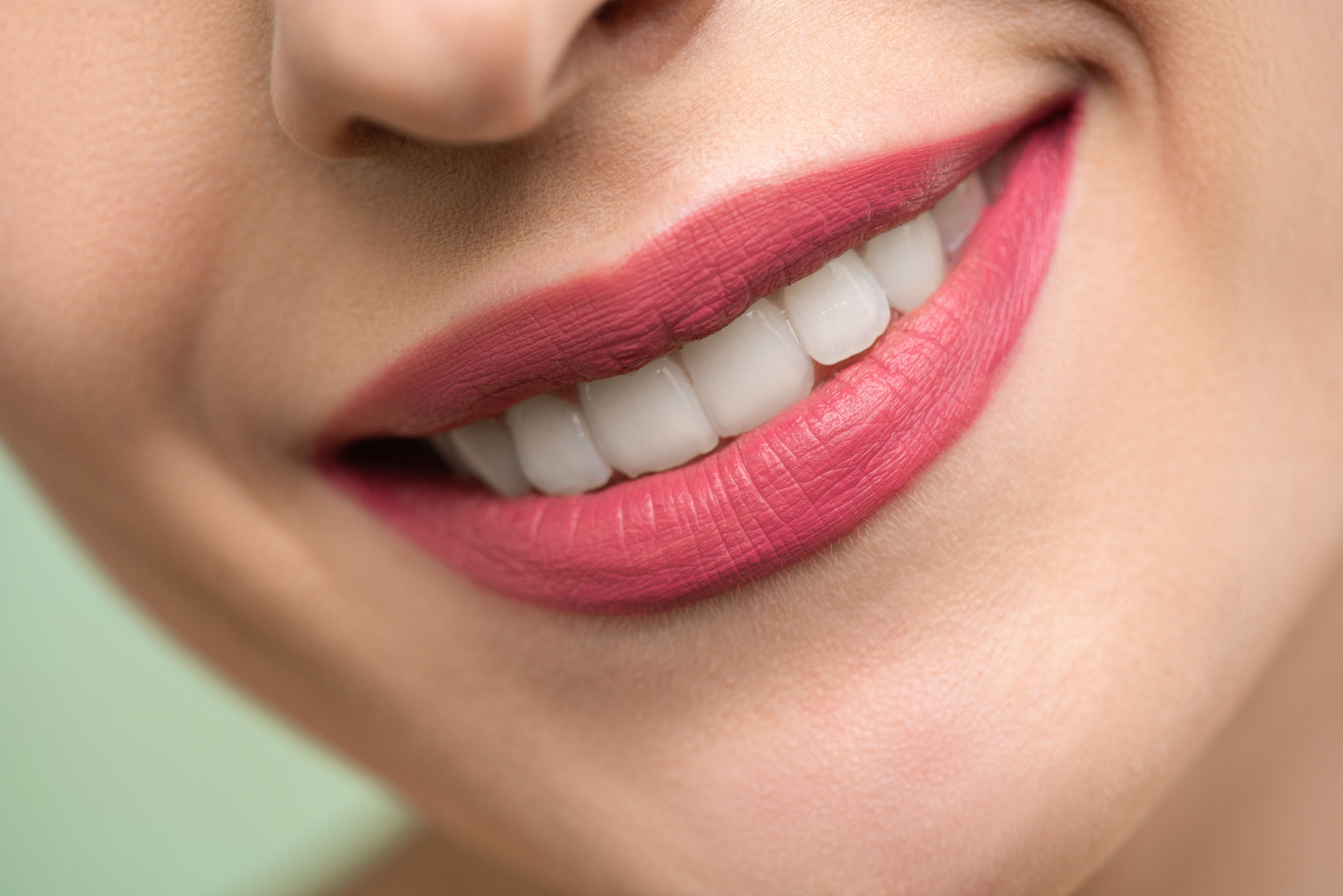 Hollywood smile transformation